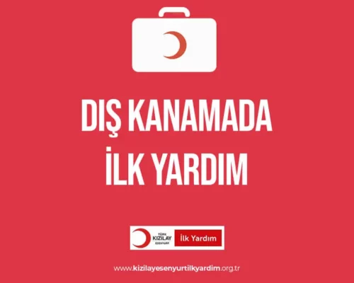 Dış Kanamada İlk Yardım